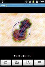 Rastreio do cancro da pele através de
        telemóvel